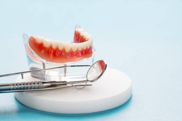 Full Mouth Reconstruction in Mount Pleasant, NC