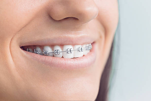 Why Choose Us for Your Dental Needs in Mount Pleasant, NC